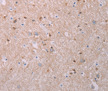 AKT2 Antibody