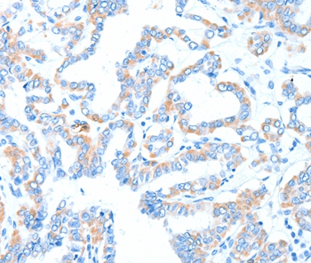 GPT Antibody