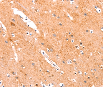 ANKZF1 Antibody
