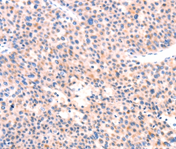 APBA2 Antibody
