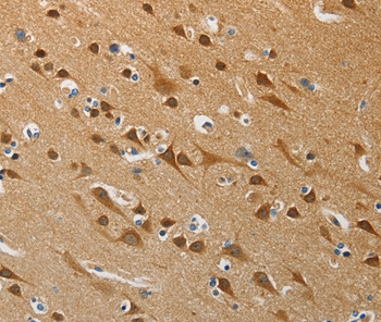 ATG4B Antibody