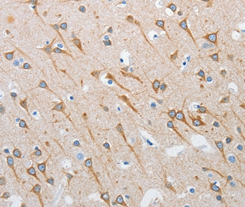 INTS1 Antibody