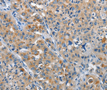 NEK1 Antibody