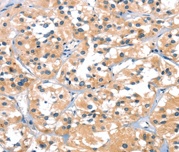 SLC6A4 Antibody