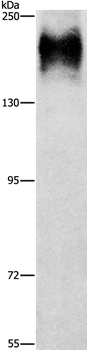 ATP7A  Antibody
