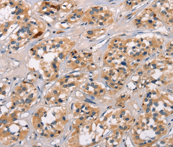 ATRN Antibody