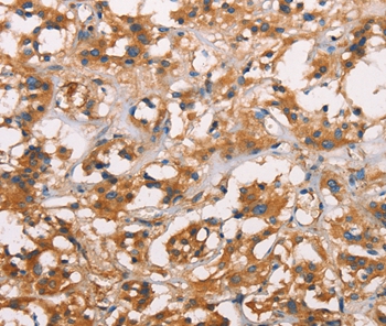 ANXA2R Antibody