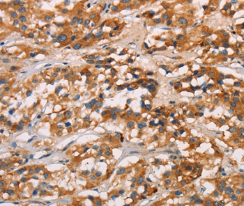CD80 Antibody