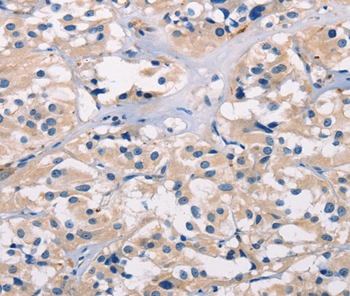BAI1 Antibody