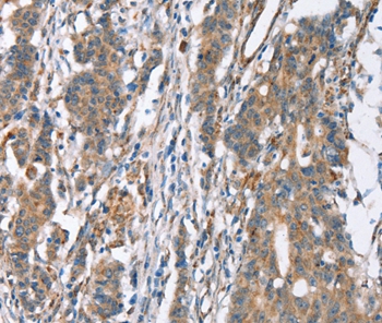 SLC4A1 Antibody
