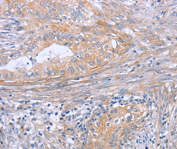 BOD1 Antibody