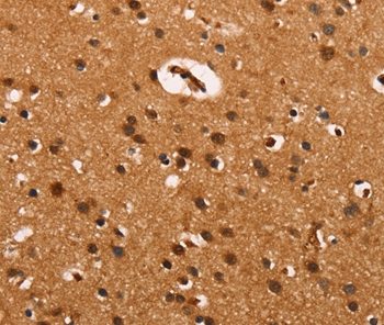 CABLES2 Antibody