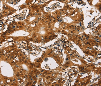 CACNA1C Antibody