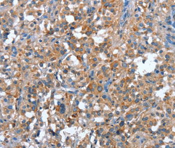 PLA2G6 Antibody