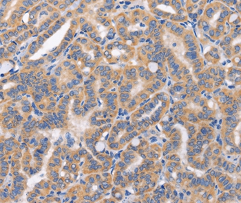 CARD17 Antibody