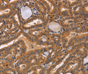CCL23 Antibody