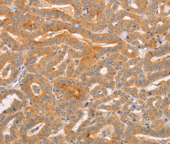 CD2AP Antibody