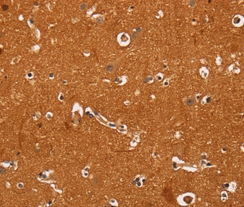 TNFRSF8 Antibody