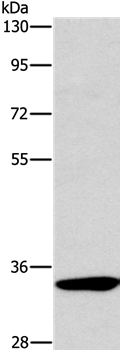 NCR1 Antibody