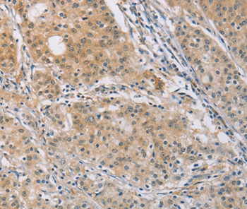CENPF Antibody