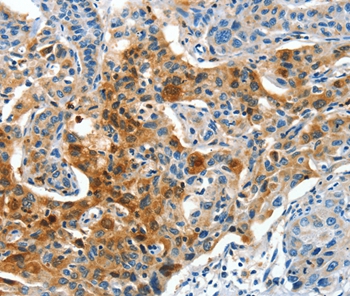 COG1 Antibody