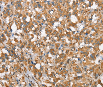 CSMD1 Antibody