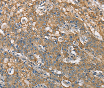 CSMD1 Antibody