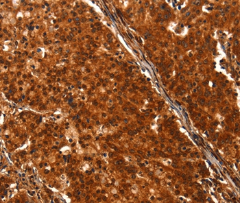 DHH Antibody