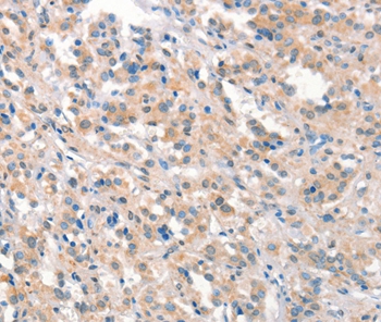 KCNB1 Antibody