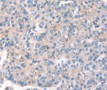 KCNB1 Antibody