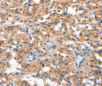 DUSP2 Antibody
