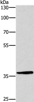 DUSP2 Antibody