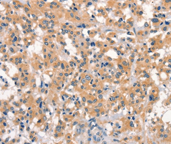EID3 Antibody