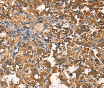 AGO1 Antibody