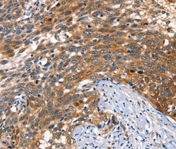 AGO1 Antibody
