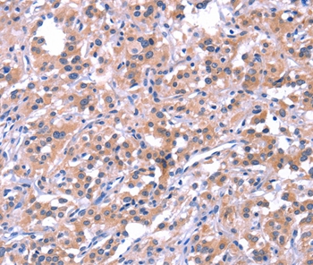EP300 Antibody