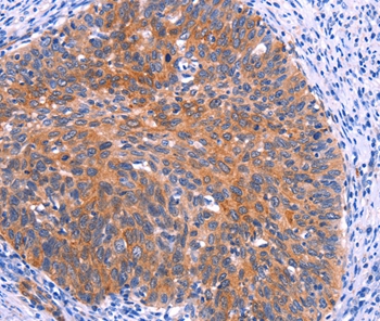 PTPN13 Antibody