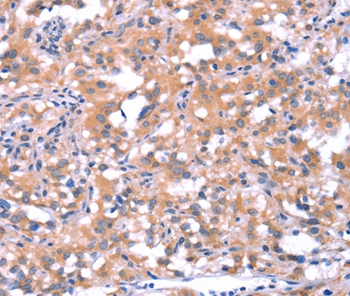 FAT1 Antibody
