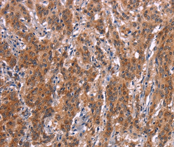 FDCSP Antibody