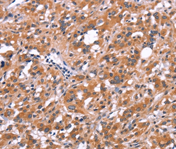 FDCSP Antibody
