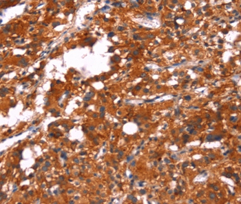 FEM1A Antibody