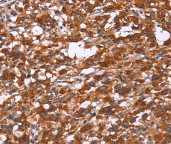 GPHN Antibody