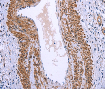 GNPAT Antibody