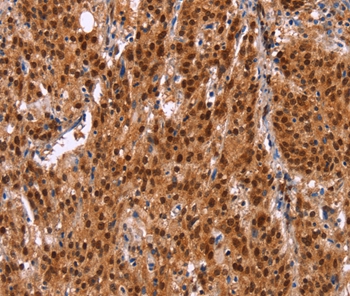 HRK Antibody