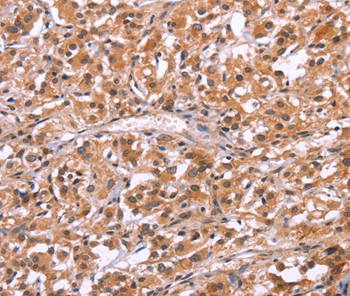 HRK Antibody