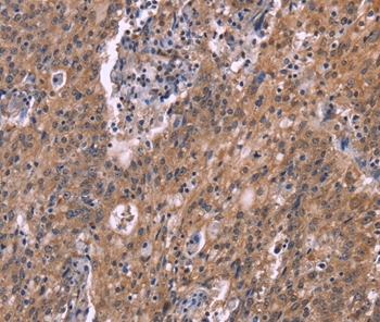 HSD11B2 Antibody