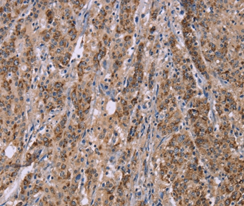 IFNA2 Antibody