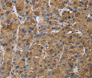 IGF2R Antibody