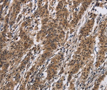 IL12RB2 Antibody