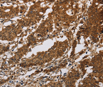 IL17RB Antibody
